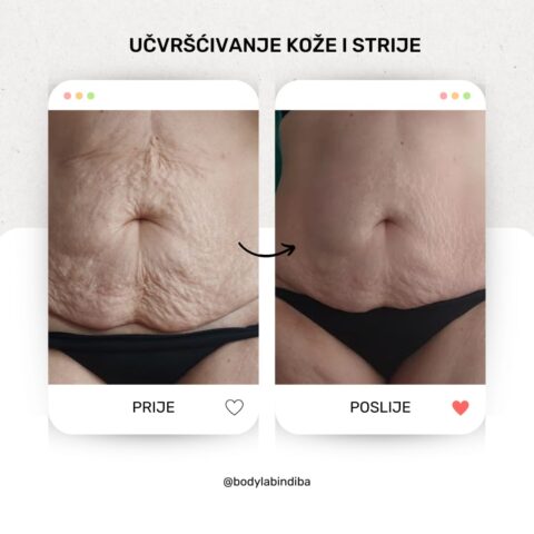 Promocija jesen 2025 - Zategnutiji trbuh -01