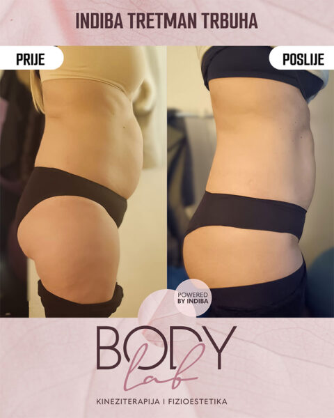 Promocija - Jesen 2025 - Zategnutiji trbuh -01