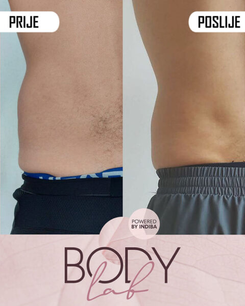 Promocija - Jesen 2025 - Zategnutiji trbuh -01