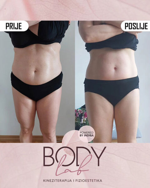 Promocija - Jesen 2025 - Zategnutiji trbuh -01